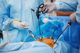 Laparoscopy in ECR